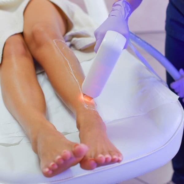 Depilação a Laser