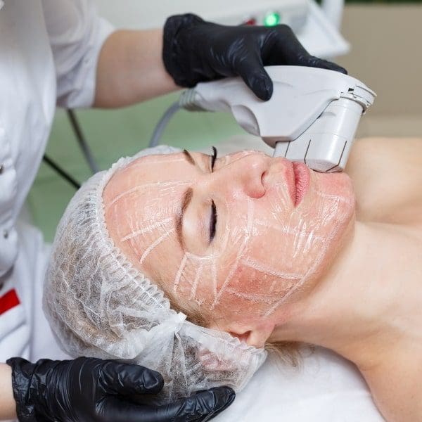 Tratamento com Ultrassom Microfocado